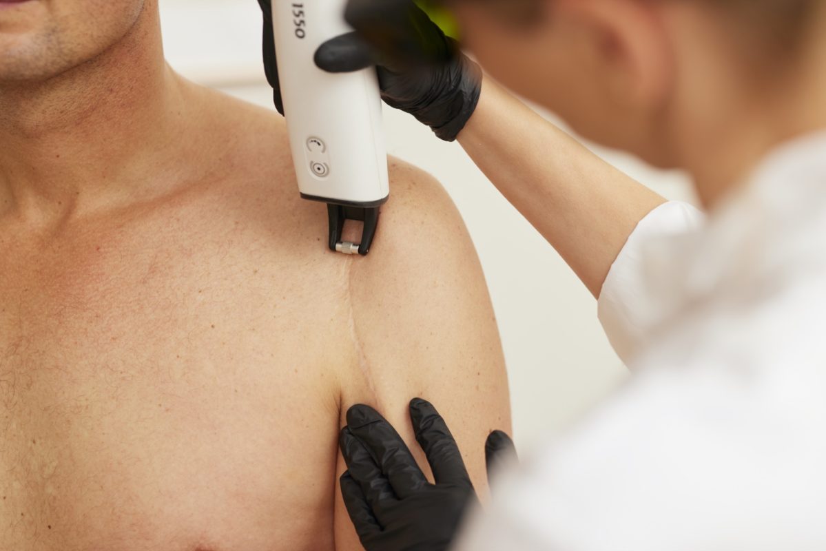 Unsere Lasersysteme in München.