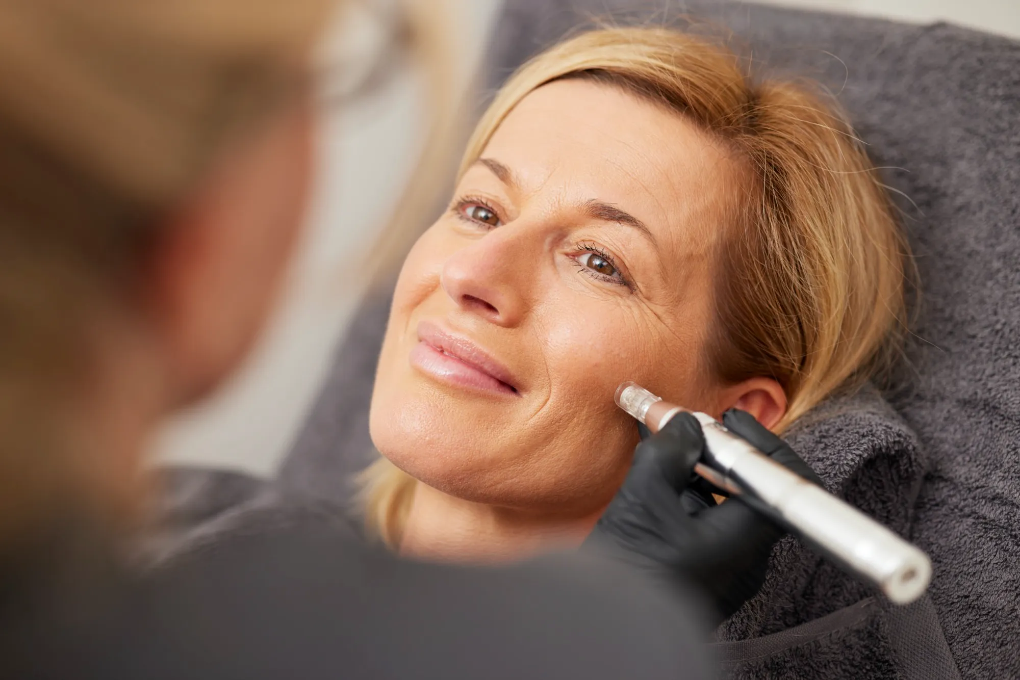 Microneedling Desktop
